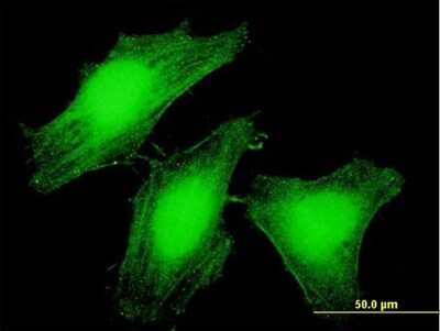 Immunocytochemistry/ Immunofluorescence: LARP6 Antibody [H00055323-B01P]