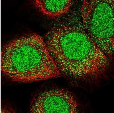 Immunocytochemistry/ Immunofluorescence: LARP7 Antibody [NBP1-85084]