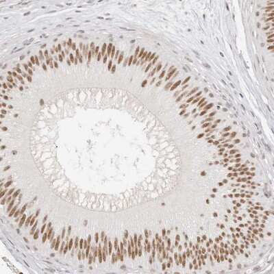 Immunohistochemistry-Paraffin: LARP7 Antibody [NBP1-85083]