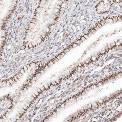 Immunohistochemistry-Paraffin: LARP7 Antibody [NBP1-85084]