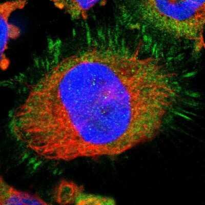 Immunocytochemistry/ Immunofluorescence: LASP1 Antibody [NBP1-82844]