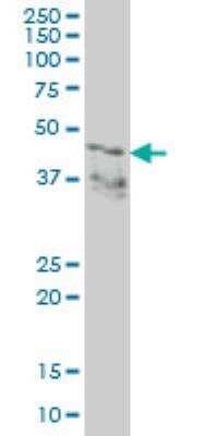 Western Blot: LASS2 Antibody (1A6) [H00029956-M01A]