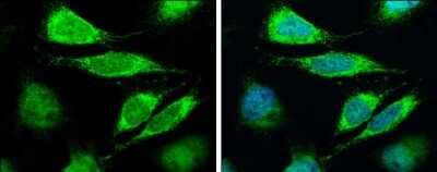Immunocytochemistry/ Immunofluorescence: LASS2 Antibody [NBP3-12946]