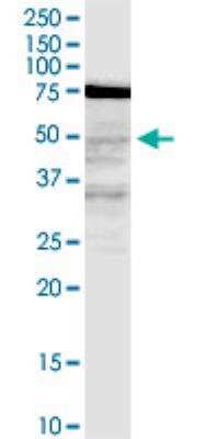 Western Blot: LASS3 Antibody (6C12) [H00204219-M02-100ug]