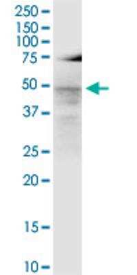 Western Blot: LASS3 Antibody (6C12) [H00204219-M02-100ug]