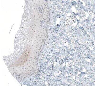 Immunohistochemistry-Paraffin: LASS3 Antibody [NBP1-84536]