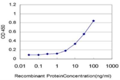 ELISA: LASS4 Antibody (7D5) [H00079603-M03]