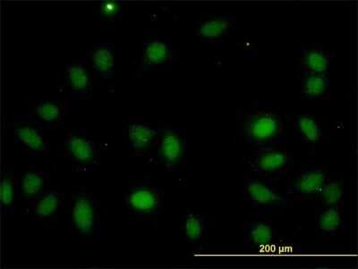 Immunocytochemistry/ Immunofluorescence: LASS4 Antibody (7D5) [H00079603-M03]
