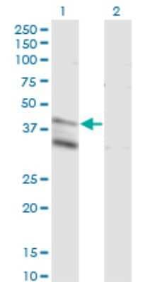 Western Blot: LASS4 Antibody (7D5) [H00079603-M03]