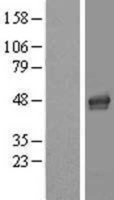 Western Blot: LASS4 Overexpression Lysate [NBL1-12443]