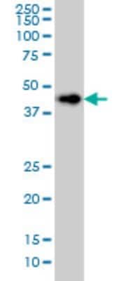 Western Blot: LASS6 Antibody (5H7) [H00253782-M01]