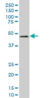 Western Blot: LASS6 Antibody (6B8) [H00253782-M02]