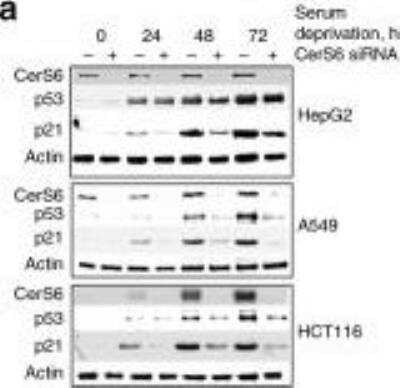 Knockdown Validated: LASS6 Antibody - BSA Free [NBP1-76965]