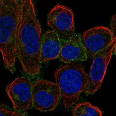 Immunocytochemistry/ Immunofluorescence: LAT Antibody [NBP1-81324]