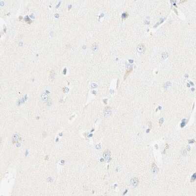 Immunohistochemistry-Paraffin: LAT Antibody [NBP1-81324]