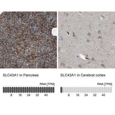 Immunohistochemistry-Paraffin: LAT3 Antibody [NBP1-87332]