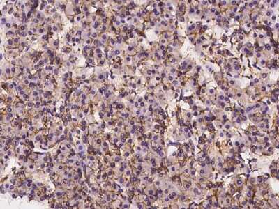 Immunohistochemistry-Paraffin: LAT3 Antibody [NBP2-98543]
