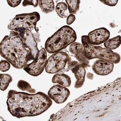 Immunohistochemistry-Paraffin: LATS1 Antibody [NBP1-86860]