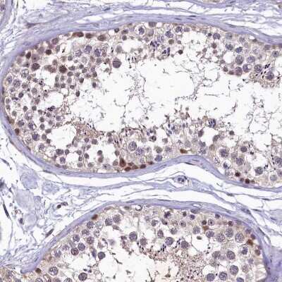 Immunohistochemistry-Paraffin: LATS2 Antibody [NBP2-14184]