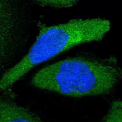Immunocytochemistry/ Immunofluorescence: LAX1 Antibody [NBP1-83662]