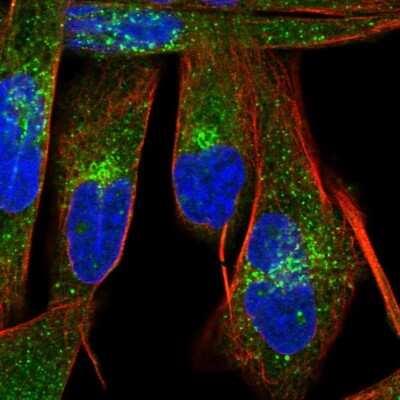 Immunocytochemistry/ Immunofluorescence: LBH Antibody [NBP1-90343]