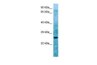 Western Blot: LBHD1 Antibody [NBP2-85203]