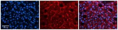 Immunohistochemistry: LBP Antibody [NBP1-58972]