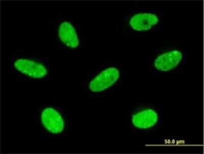 Immunocytochemistry/ Immunofluorescence: LBX2 Antibody (3A5) [H00085474-M02]