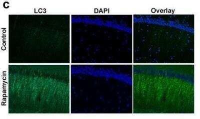 Immunohistochemistry: LC3 Antibody Pack [NB910-40435]
