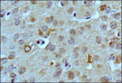 Immunohistochemistry: LC3 Antibody Pack [NBP2-59703]
