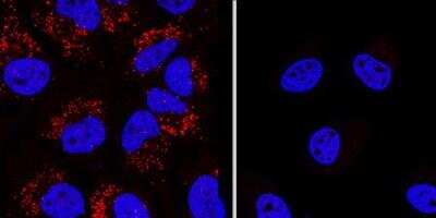 Knockout Validated: LC3 Antibody Pack [NB910-40435]