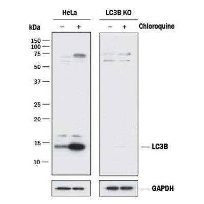 Knockout Validated: LC3 Antibody Pack [NBP2-59703]