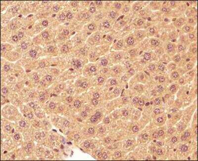 Immunohistochemistry-Paraffin: LC3A Antibody [NBP1-19167]