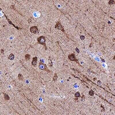 Immunohistochemistry-Paraffin: LC3A Antibody (2312D) - Azide and BSA Free [NBP2-80828]