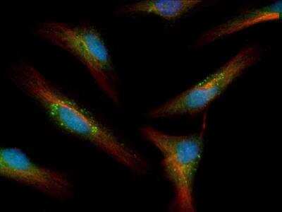 Immunocytochemistry/ Immunofluorescence: LC3A Antibody [NBP1-19167]