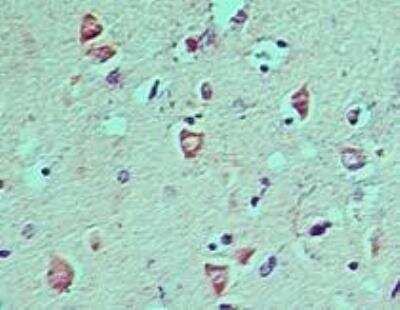 Immunohistochemistry-Paraffin: LC3A Antibody [NBP2-24394]