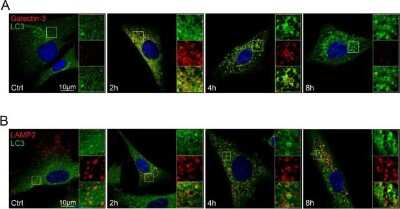 Immunocytochemistry/Immunofluorescence Staining of LC3B in Treated Fibroblasts