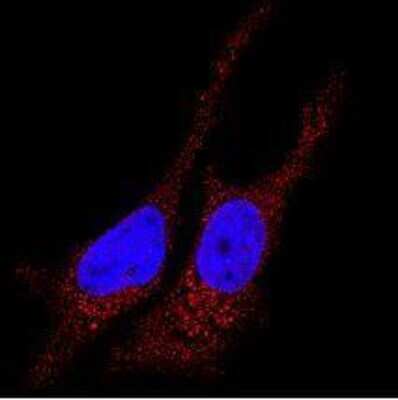 Immunocytochemistry/Immunofluorescence Staining of LC3B in HeLa Cells