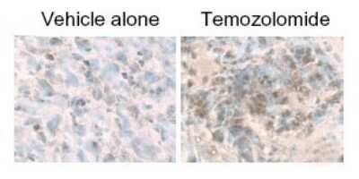 Immunohistochemical Staining of LC3B in Treated U87-MG Cultured and Subcutaneous Tumors