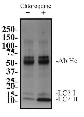 Immunoprecipitation: LC3B Antibody (1251A) - Azide and BSA Free [NBP2-80829]