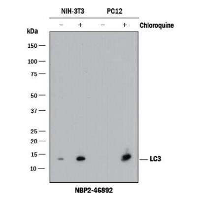 Western Blot: LC3B Antibody (1251A)Azide and BSA Free [NBP2-80829]