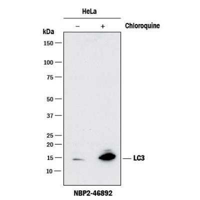Western Blot: LC3B Antibody (1251A)Azide and BSA Free [NBP2-80829]
