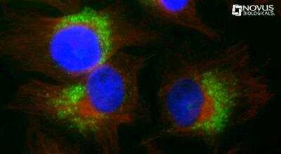 Immunocytochemistry/ Immunofluorescence: LC3B Antibody (1251A) - BSA Free [NBP2-46892]