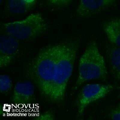 Immunocytochemistry/ Immunofluorescence: LC3B Antibody (1251B) - BSA Free [NBP2-60735]