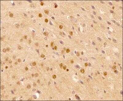 Immunohistochemistry-Paraffin: LC3B Antibody (1251D) - Azide and BSA Free [NBP2-80830]