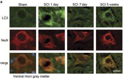 Staining of LC3 in Rat Neurons