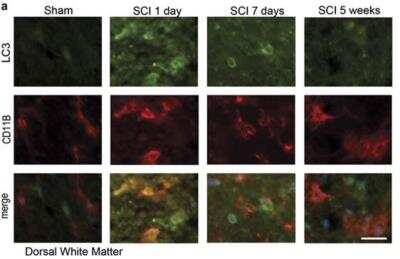 Staining of LC3 in Rat Spinal Cord