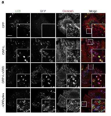 Staining of LC3 in MelJuSo Cells