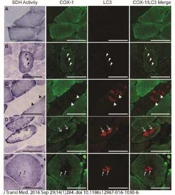 Detection of LC3 in Human Muscle Fibers
