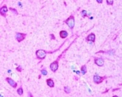 Immunohistochemistry in Brain Tissue Using Biotinylated LC3B Antibody